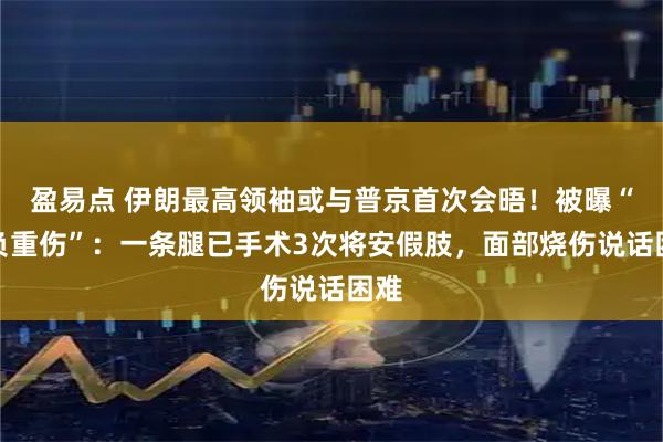 盈易点 伊朗最高领袖或与普京首次会晤！被曝“身负重伤”：一条腿已手术3次将安假肢，面部烧伤说话困难
